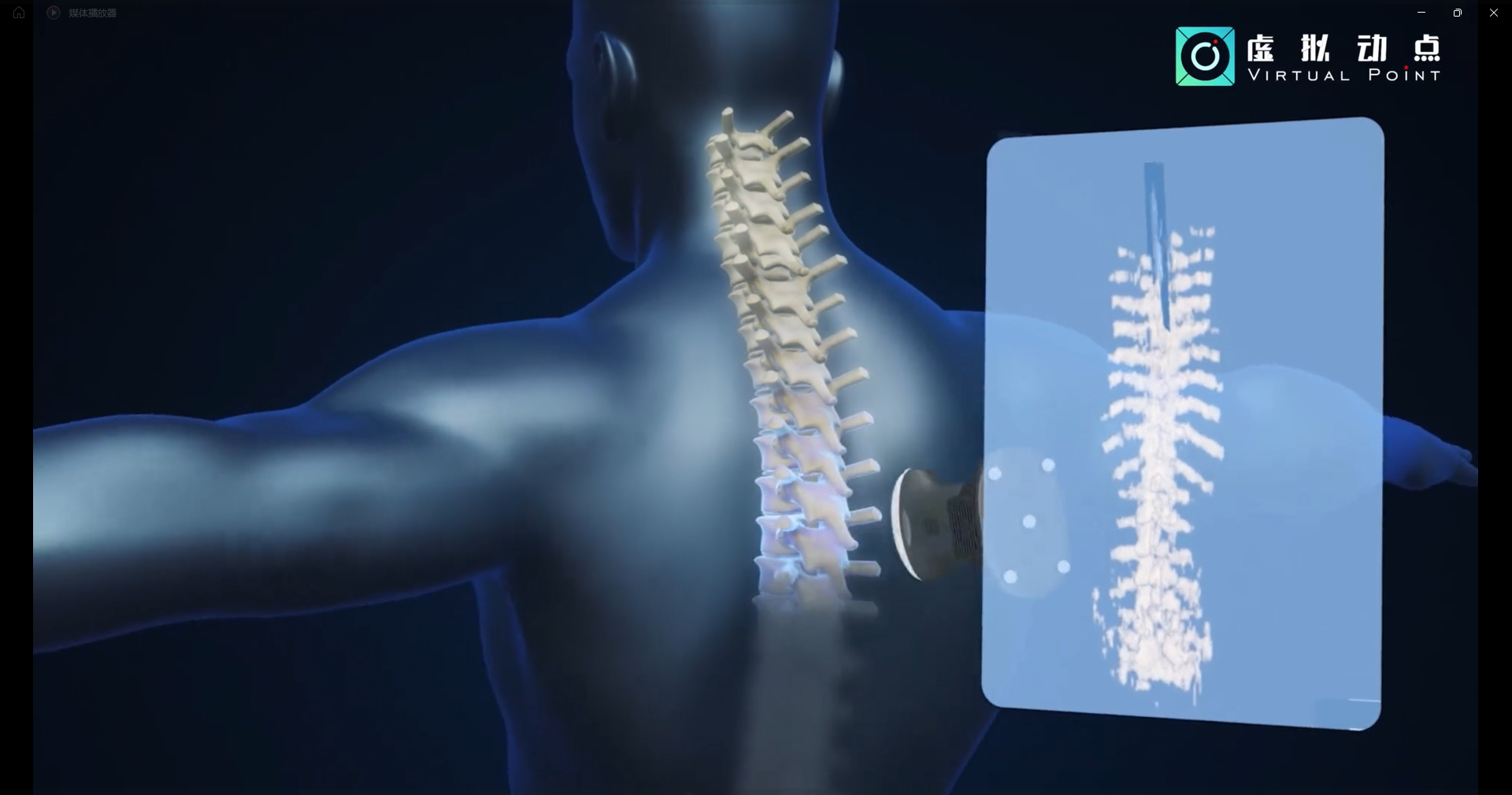 OptiTrack利用于3D超声成像在脊柱诊断